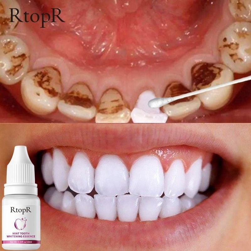 Unisex Teeth Oral Hygiene Essence Whitening Essence Daily Use Effective Remove Plaque Stains Cleaning Product teeth Cleaning Water 10ml