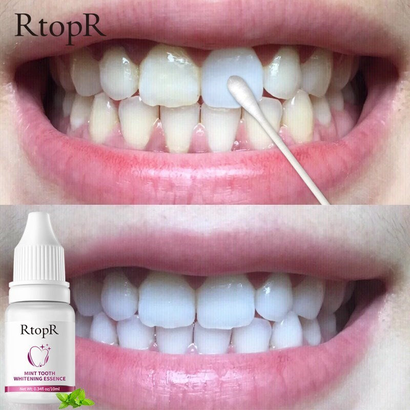 Unisex Teeth Oral Hygiene Essence Whitening Essence Daily Use Effective Remove Plaque Stains Cleaning Product teeth Cleaning Water 10ml